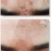 محصولات شرکت نیوشانیک|آرایشی، بهداشتی، درمانی|تهران, شهرک امام خمینی|دیوار