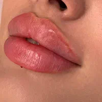 فیلر بوتاکس لیزر هایفوتراپی