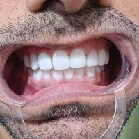 دندانپزشکی. لابراتواری