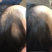 اسکالپ تراپی سر|خدمات آرایشگری و زیبایی|شاهین‌شهر, چمران|دیوار