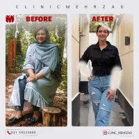 لاغری با کلینیک مهرزاد