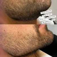 تخفیف ویژه|خدمات آرایشگری و زیبایی|تهران, سلسبیل شمالی|دیوار