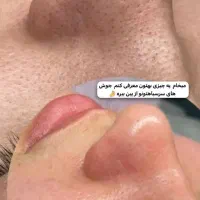 انجام یک خدمت زیبایی و دریافت یک خدمت هدیه