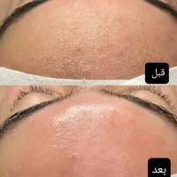 تخفیفات ویژه فیشال های تخصصی ، فقط ب مدت یک هفته