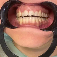 دندانپزشکی ایمپلنت+لمینت+کامپوزیت+ارتودنسی اقساط|خدمات آرایشگری و زیبایی|مشهد, سجاد شهر|دیوار