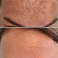 دکتر خورسندی نژاد پوست و زیبایی/رفع لک،جای جوش