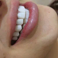 خدمات دندان پزشکی و دندانسازی با قیمت باورنکردنی