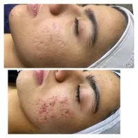 پاکسازی پوست