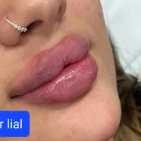 آف محدود ژل و بوتاکس فقط سی سی۴۵۰تا آخر هفته|خدمات آرایشگری و زیبایی|اهواز, پردیس|دیوار