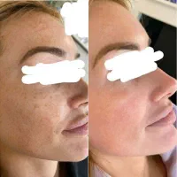 معجزه با اکسیر های سلامتی|خدمات آرایشگری و زیبایی|چناران, |دیوار