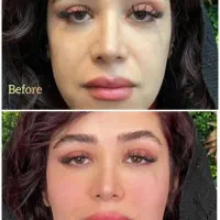 خدمات ژل و بوتاکس ،مزوتراپی و...