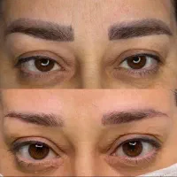 ریموو تخصصی پاک کردن تتو ابرو و خط چشم تضمینی