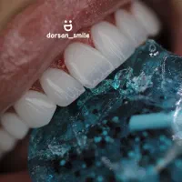 کامپوزیت دندانپزشکی