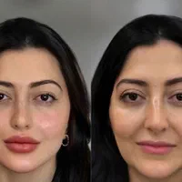 مرکز تخصصی جوانسازی،prf  و هایفو