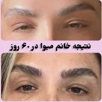 مژه و ابروهاتون تقویت کن