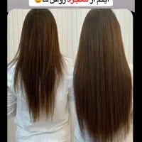 بمب سرعت رشد مو