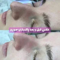فشیال تخصص پوست|خدمات آرایشگری و زیبایی|شیراز, بعثت|دیوار
