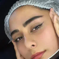 میکروبلیدینگ به سبک میکرونانو به مدت محدود فقط ۳۵۰