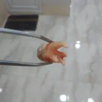 خدمات دندانپزشکی با قیمت استثنایی