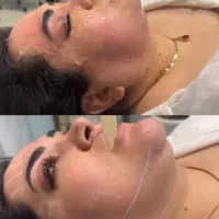 جشنواره هایفو تراپی با دستگاه ۵ بعدی