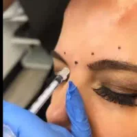 فیشال تخصصی، برداشت خال و ککو مک، ژل و بوتاکس|خدمات آرایشگری و زیبایی|شاهرود, |دیوار