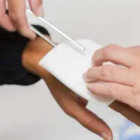 برای جای سوختگی شدید کسی دکتر سراغ داره