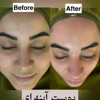 خدمات فیشیال ، پاکسازی ، جوانسازی پوست|خدمات آرایشگری و زیبایی|قم, شهرک قدس|دیوار