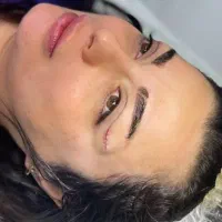 بلفاروپلاستی،ساکشن غبغب،بوکال فت،سانترال لب