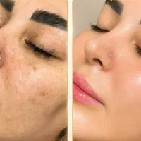 معجزه پوستت پیش منه