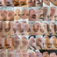 پاکسازی/آبرسانی تخصصی پوست