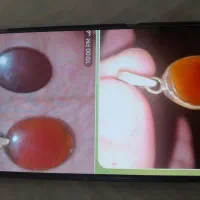 دوتا عقیق یمن خیلی قیمت پایین هردو ۱۵۰۰