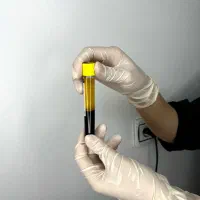 تخفیف ویژه پی آر پی