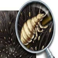 پودر شپش و رشک|آرایشی، بهداشتی، درمانی|رباط‌کریم, رباط‌کریم|دیوار