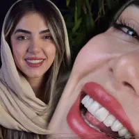 دندانپزشکی اقساط لمینت ایمپلنت و کلیه خدمات دندان|خدمات آرایشگری و زیبایی|مشهد, سجاد شهر|دیوار