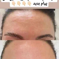 سرم لیفتینگ گاتیو|آرایشی، بهداشتی، درمانی|شیراز, طلاب|دیوار
