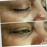 تنها کرم لیفت صورت(نمایندگی رسمی لاکچری کوین)|آرایشی، بهداشتی، درمانی|تهران, ابن بابویه|دیوار