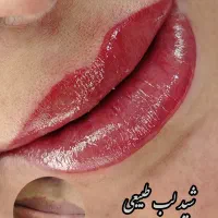 فیبروز وشیدلب فقط وفقط هزینه مواد