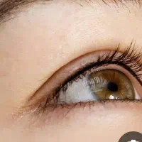 انجام بن مژه با بهترین مواد و بی حسی در کلینیک