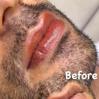 پاکسازی پوست میکروبلیدینگ ابرو اقایان شیدلب اقایان|خدمات آرایشگری و زیبایی|مشهد, هفت تیر (حافظ)|دیوار