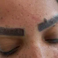 آموزش ریموو تاتو|خدمات آموزشی|گرگان, |دیوار