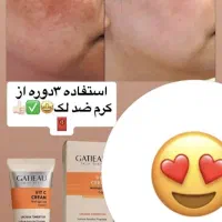 کرم ویتامین سی c گاتیو بیوممتیک