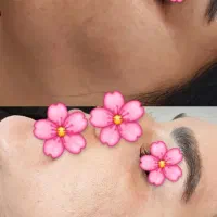 لیزرتتوابرو،لیزرهالیوودی کیوسوئیچ|خدمات آرایشگری و زیبایی|بروجرد, |دیوار