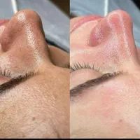 پاکسازی و فیشیال پوست|خدمات آرایشگری و زیبایی|باقرشهر, |دیوار