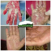 پمادسوختگی قلعه نوخرقان|آرایشی، بهداشتی، درمانی|شیراز, طلاب|دیوار