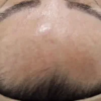 فیشال درمانی تخصصی|خدمات آرایشگری و زیبایی|بندر ماهشهر, |دیوار