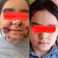 پاکسازی کبد چرب توی ۲۰ روز نتیجه خواهی گرفت|آرایشی، بهداشتی، درمانی|تبریز, |دیوار