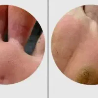 برای همیشه از شرش خلاص شو تو کوتاه ترین زمان ممکن|خدمات زیبایی و سلامت|تهران, تهرانسر شمالی|دیوار