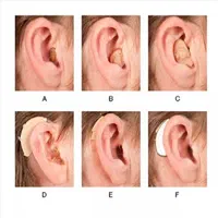 کلینیک فروش سمعک