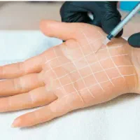 مدل برای بوتاکس|خدمات آرایشگری و زیبایی|اهواز, رسالت|دیوار