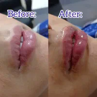 مطب پوست،مو،زیبایی دکتر الهام متمم